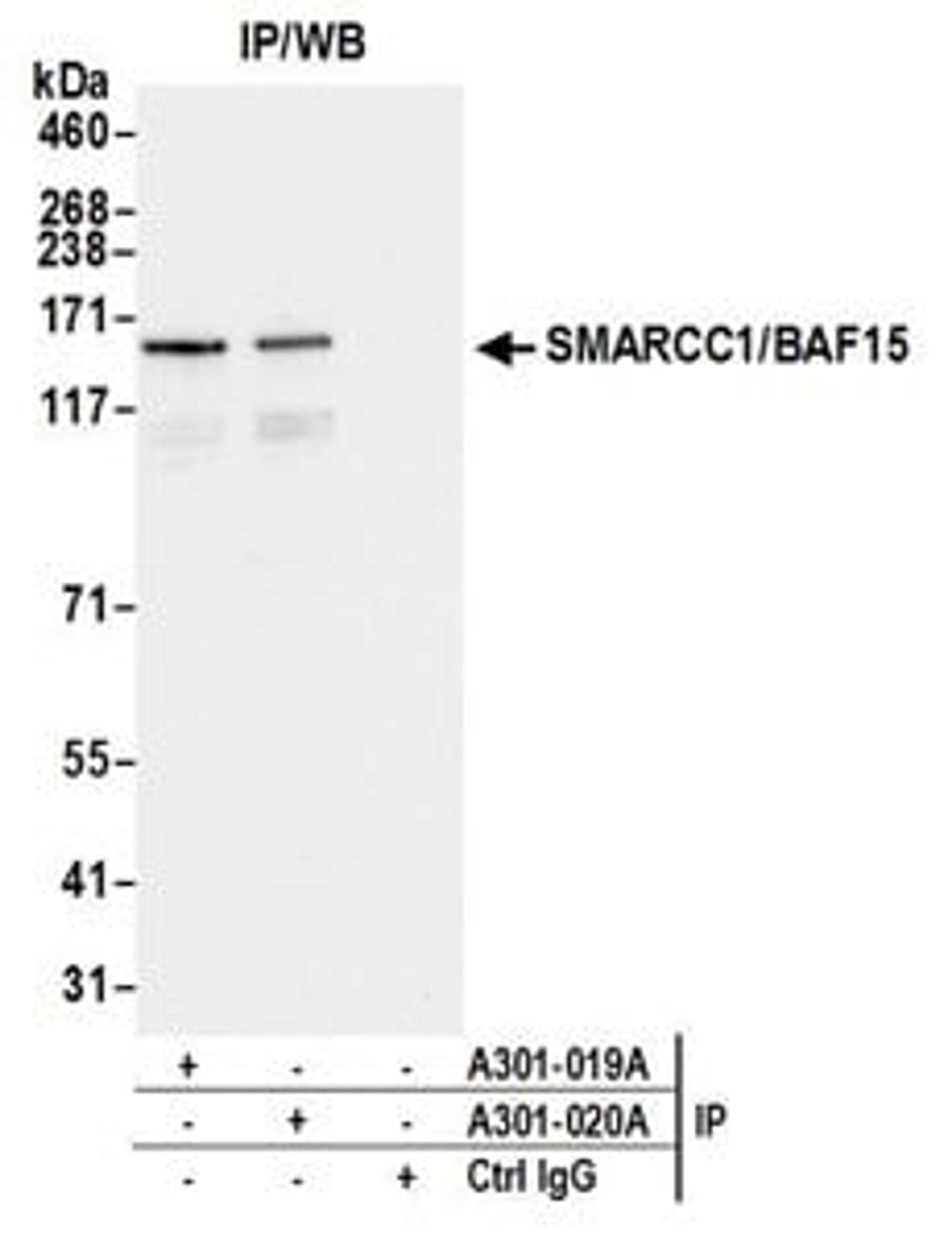 Detection of human SMARCC1/BAF155 by western blot of immunoprecipitates.