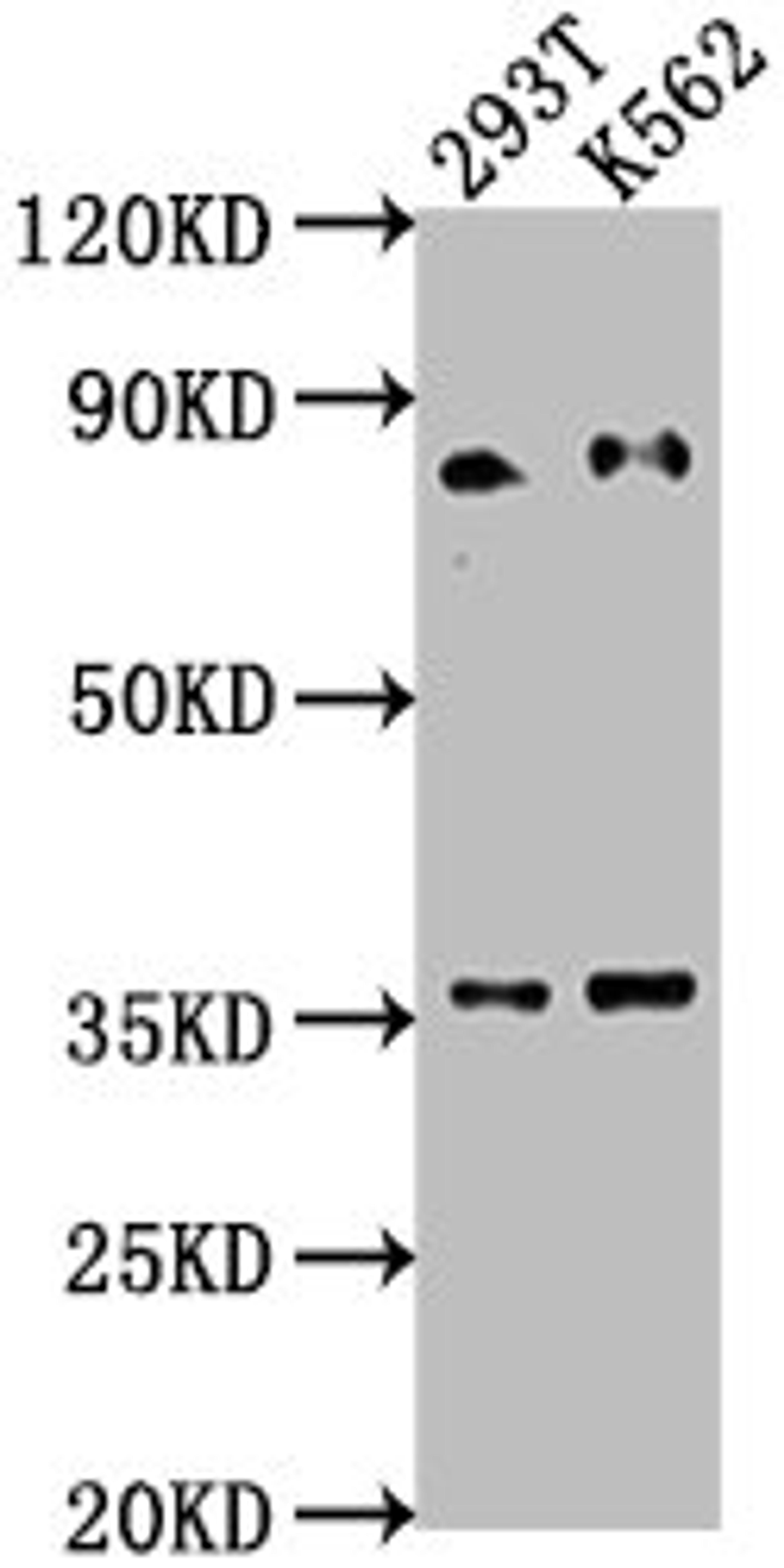 Western Blot. Positive WB detected in: 293T whole cell lysate, K562 whole cell lysate. All lanes: SNRK antibody at 1:2000. Secondary. Goat polyclonal to rabbit IgG at 1/50000 dilution. Predicted band size: 85, 28 kDa. Observed band size: 85 kDa. 