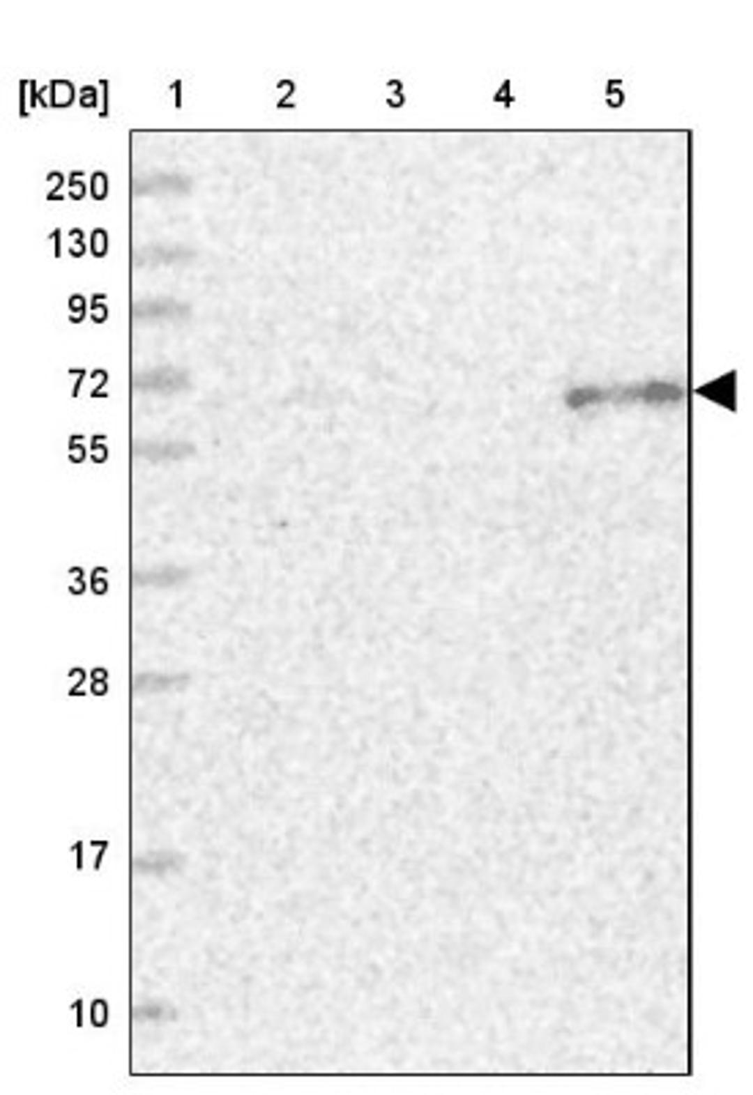 Western Blot: ETFDH Antibody [NBP1-83950] - Lane 1: Marker [kDa] 250, 130, 95, 72, 55, 36, 28, 17, 10<br/>Lane 2: Human cell line RT-4<br/>Lane 3: Human cell line U-251MG sp<br/>Lane 4: Human plasma (IgG/HSA depleted)<br/>Lane 5: Human liver tissue