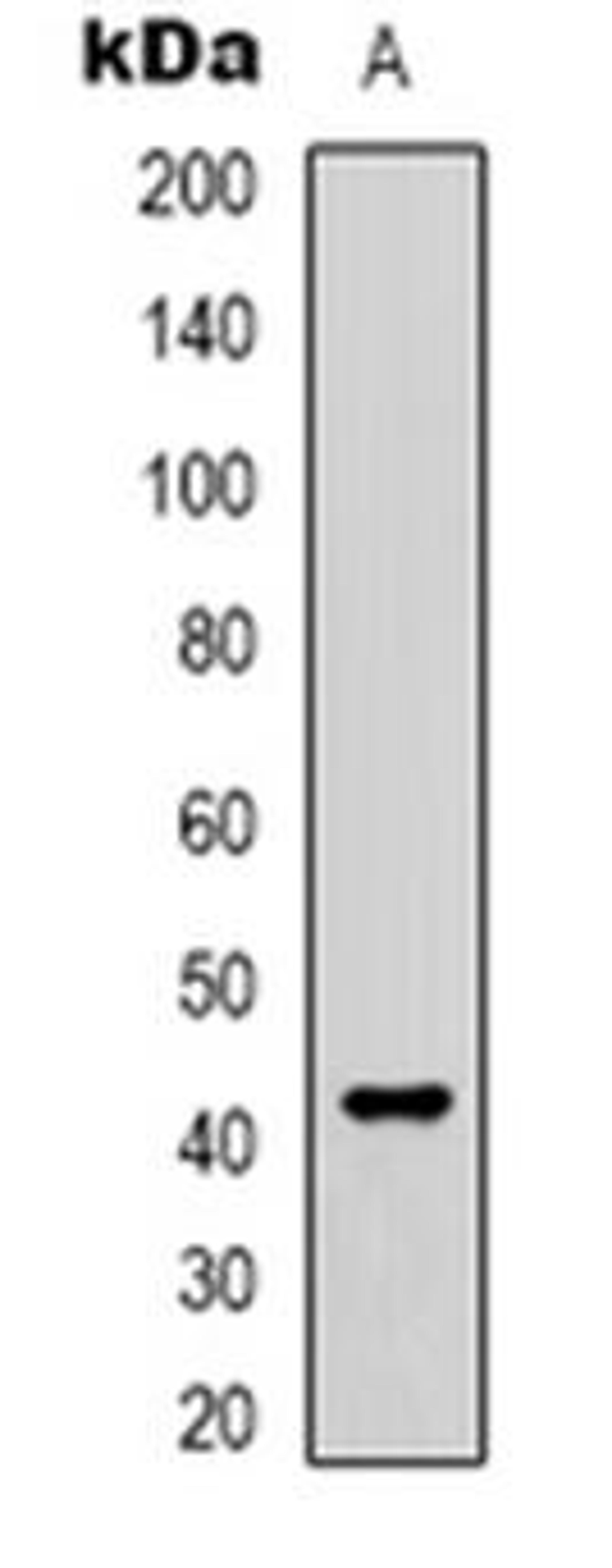 Western blot analysis of Cone Arrestin expression in human lung (Lane 1) whole cell lysates using ARR3 antibody