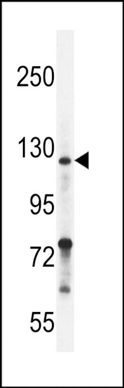 Western blot analysis in ZR-75-1 cell line lysates (35ug/lane).This demonstrates the Neuropilin-2 antibody detected the Neuropilin-2 protein (arrow).