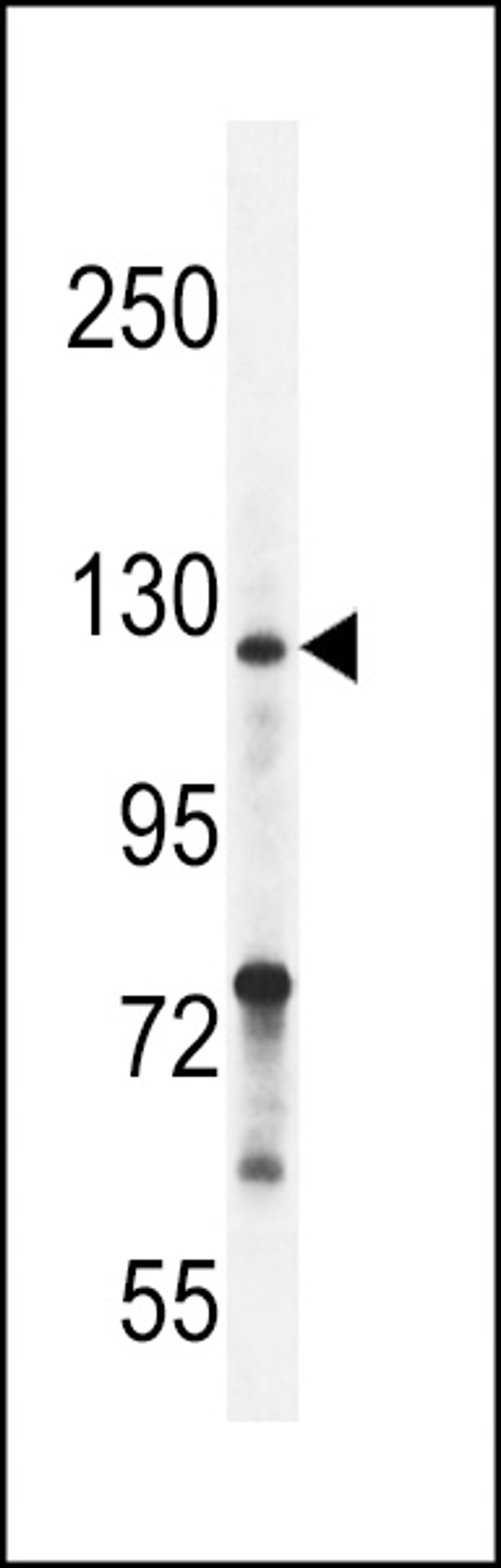 Western blot analysis in ZR-75-1 cell line lysates (35ug/lane).This demonstrates the Neuropilin-2 antibody detected the Neuropilin-2 protein (arrow).