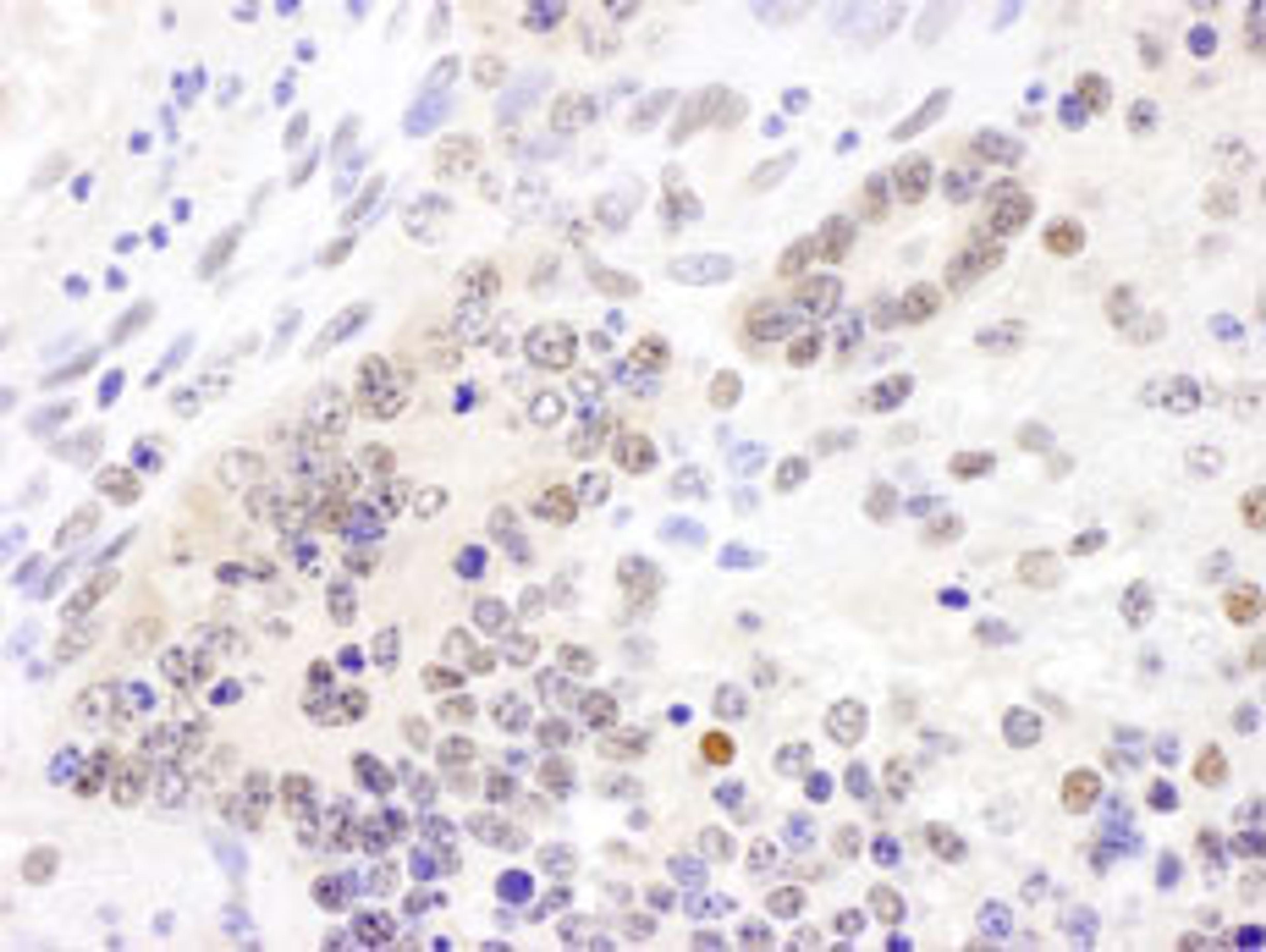 Detection of mouse Cul4B by immunohistochemistry.