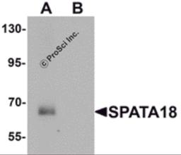 Western blot analysis of SPATA18 in rat lung tissue lysate with SPATA18 antibody at 1 μg/mL in (A) the absence and (B) the presence of blocking peptide