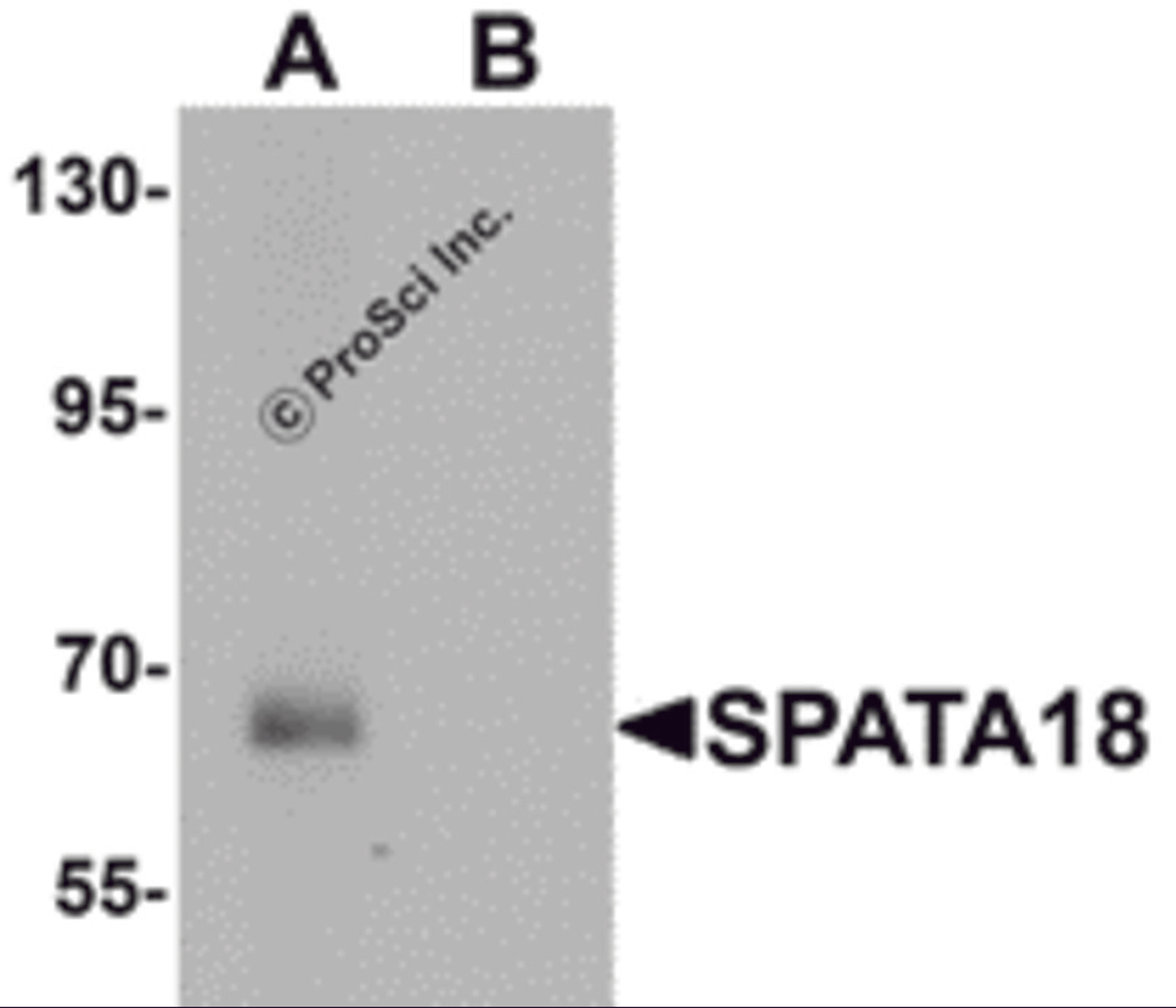 Western blot analysis of SPATA18 in rat lung tissue lysate with SPATA18 antibody at 1 μg/mL in (A) the absence and (B) the presence of blocking peptide