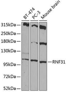 Western blot - RNF31 antibody (A14139)