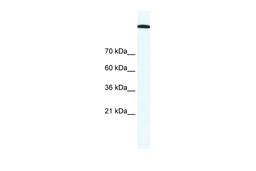 Antibody used in WB on Human HepG2 at 1.25 ug/ml.