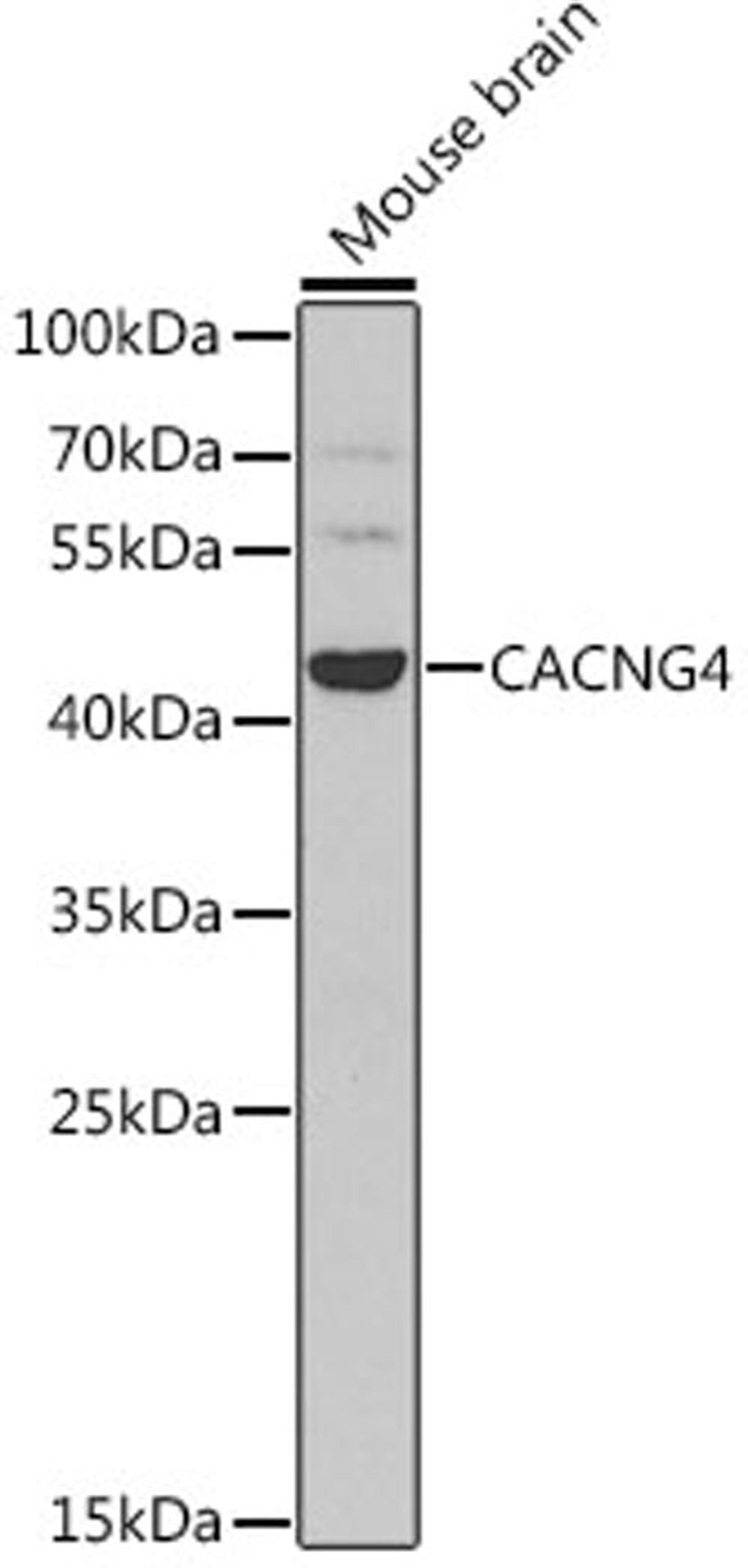 Western blot - CACNG4 antibody (A7588)