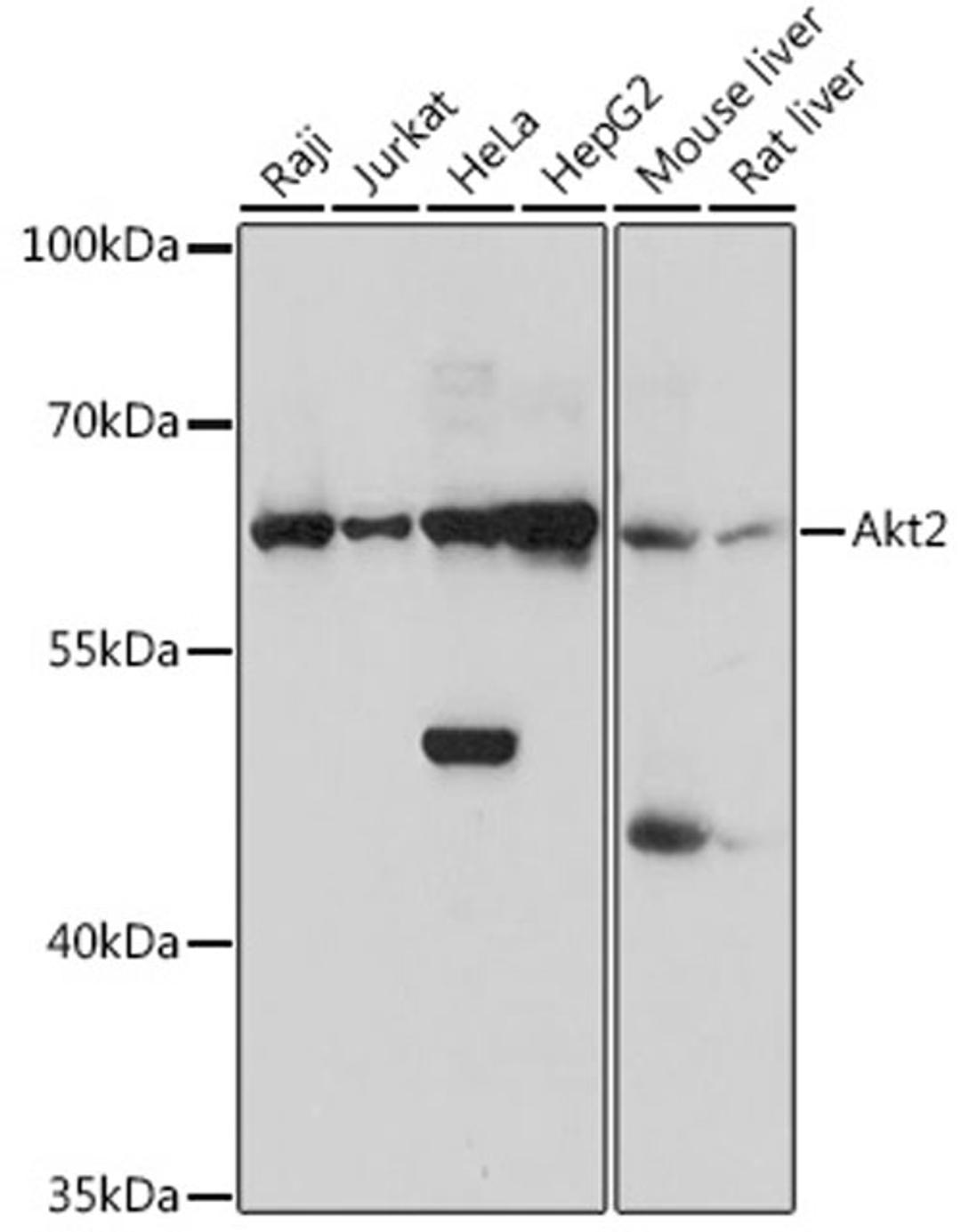 Western blot - Akt2 antibody (A1250)