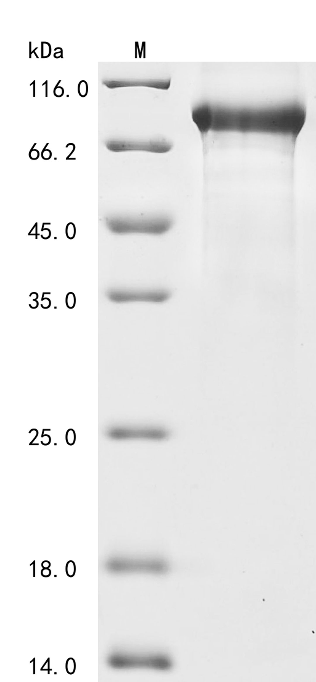 (Tris-Glycine gel) Discontinuous SDS-PAGE (reduced) with 5% enrichment gel and 15% separation gel.