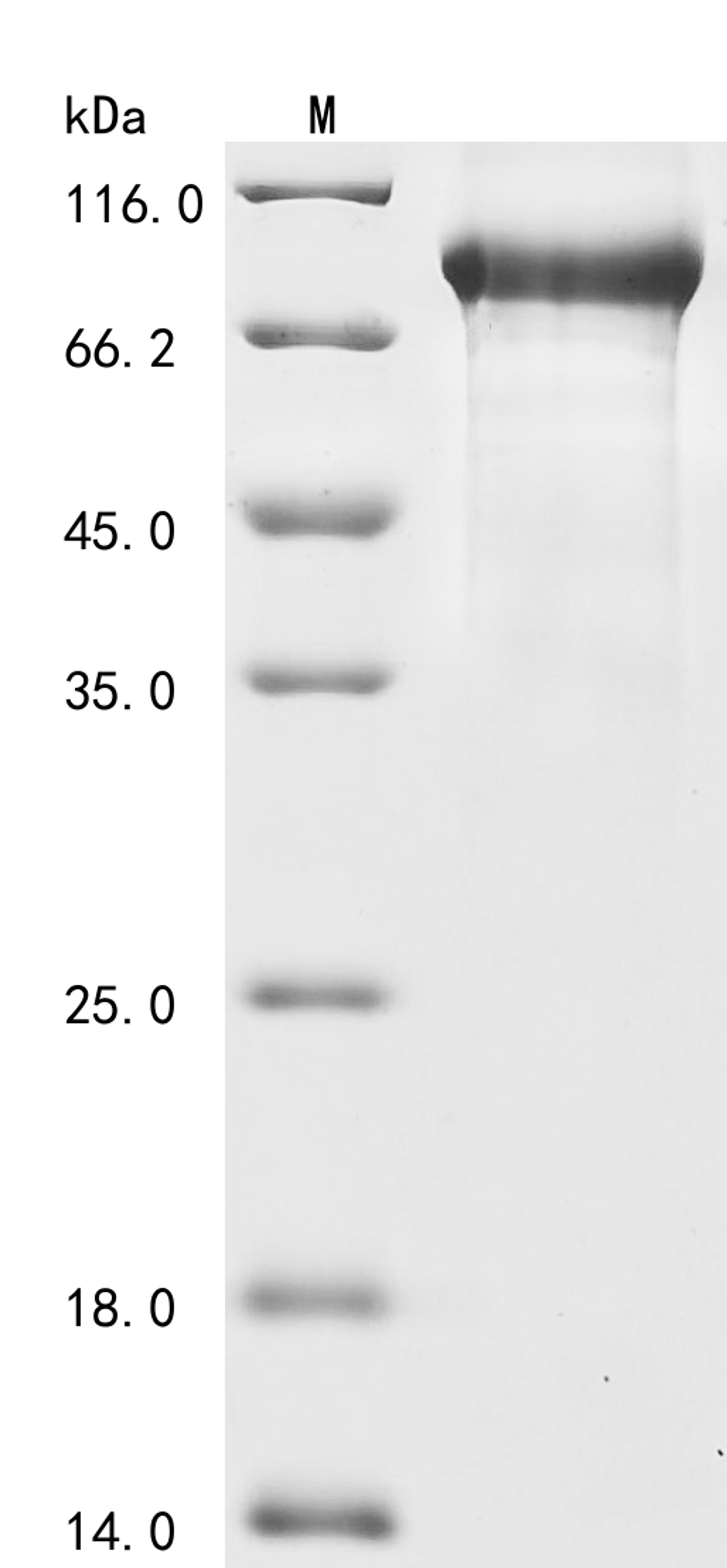 (Tris-Glycine gel) Discontinuous SDS-PAGE (reduced) with 5% enrichment gel and 15% separation gel.
