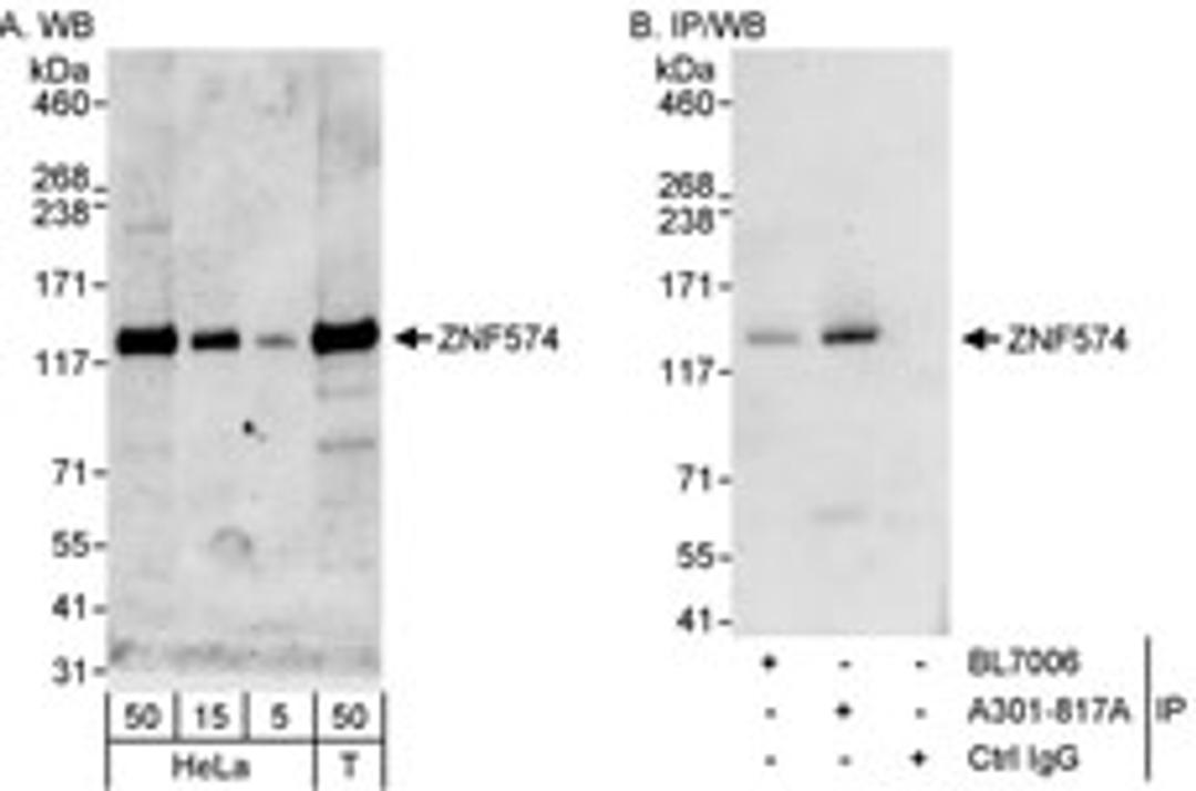 Detection of human ZNF574 by western blot and immunoprecipitation.