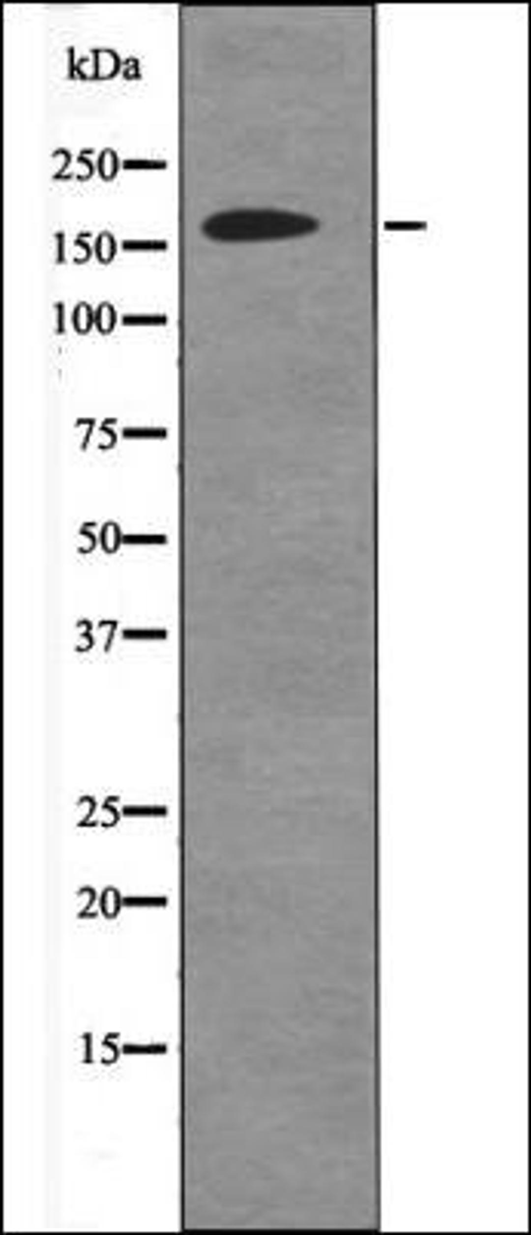 Western blot analysis of HepG2 whole cell lysates using DAPK1 -Phospho-Ser736- antibody