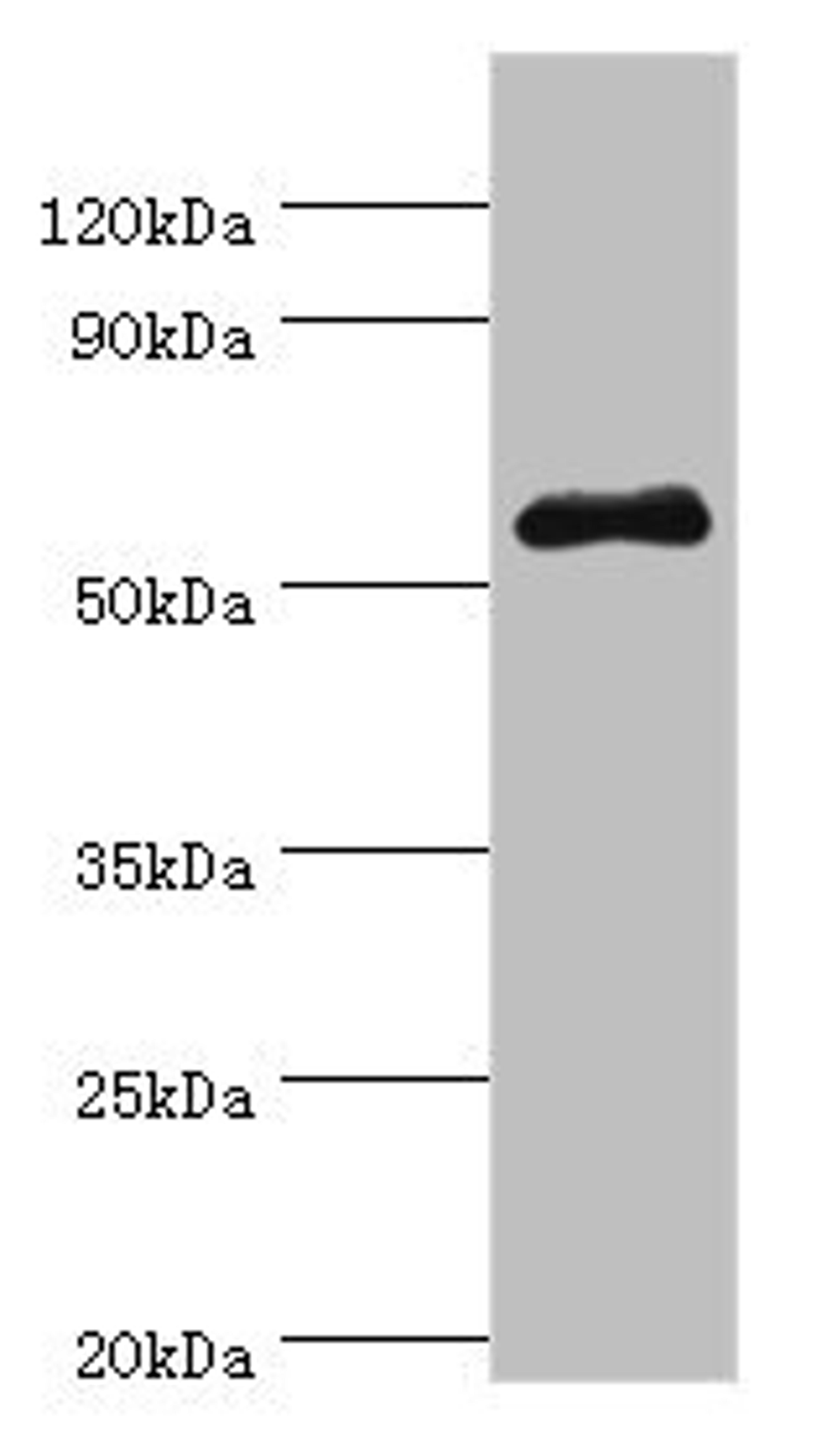 Western blot. All lanes: SEMG1 antibody at 4ug/ml + Mouse gonad tissue. Secondary. Goat polyclonal to rabbit IgG at 1/10000 dilution. Predicted band size: 53, 46 kDa. Observed band size: 53 kDa. 