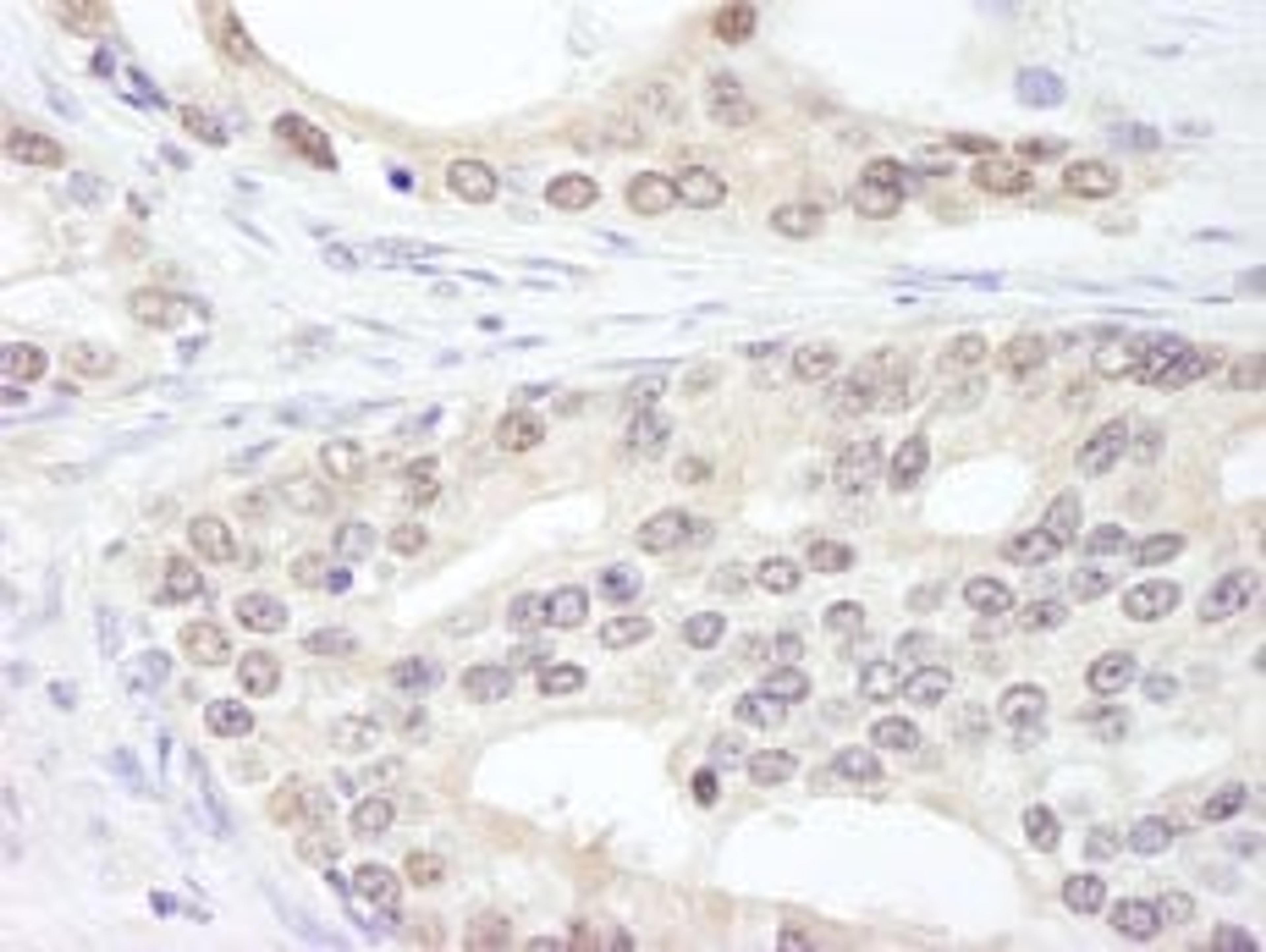 Detection of human SF3a120/SAP114 by immunohistochemistry.