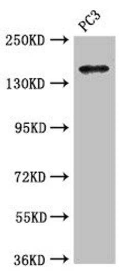 Western Blot. Positive WB detected in: PC-3 whole cell lysate. All lanes: ASTN2 antibody at 3.4µg/ml. Secondary. Goat polyclonal to rabbit IgG at 1/50000 dilution. Predicted band size: 149, 143, 148, 50, 45 kDa. Observed band size: 149 kDa