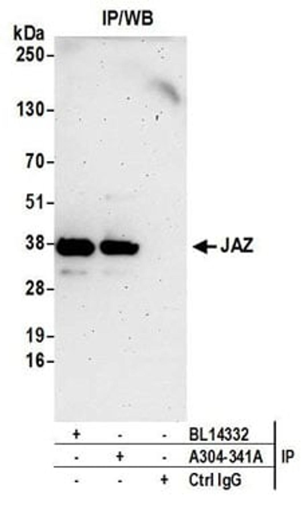 Detection of human JAZ by western blot of immunoprecipitates.