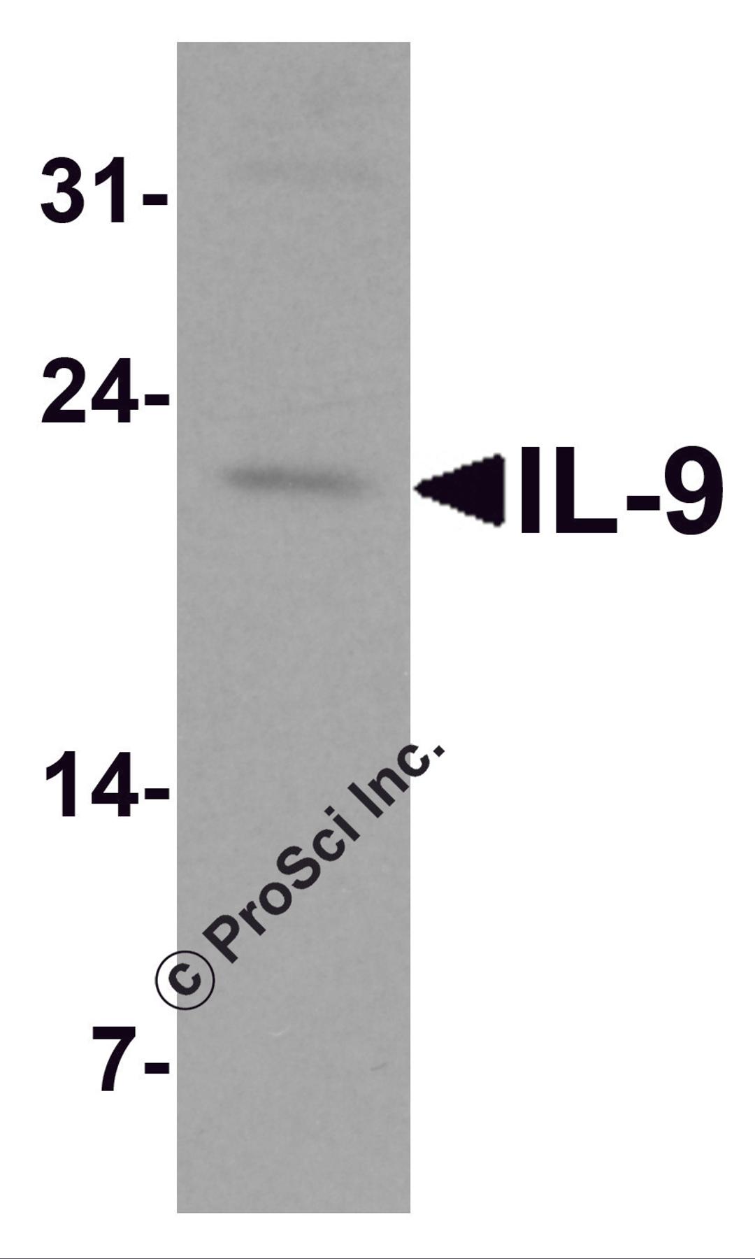 Western blot analysis of IL-9 in human spleen tissue lysate at 1 &#956;g/ml.