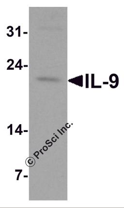 Western blot analysis of IL-9 in human spleen tissue lysate at 1 μg/ml.