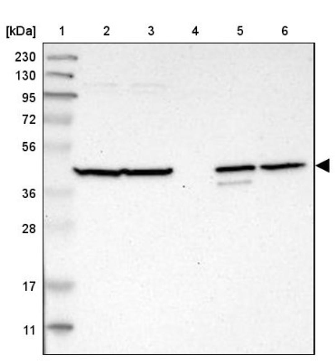 Western Blot: C1orf159 Antibody [NBP1-93971] - Lane 1: Marker [kDa] 230, 130, 95, 72, 56, 36, 28, 17, 11<br/>Lane 2: Human cell line RT-4<br/>Lane 3: Human cell line U-251MG sp<br/>Lane 4: Human plasma (IgG/HSA depleted)<br/>Lane 5: Human liver tissue<br/>Lane 6: Human tonsil tissue