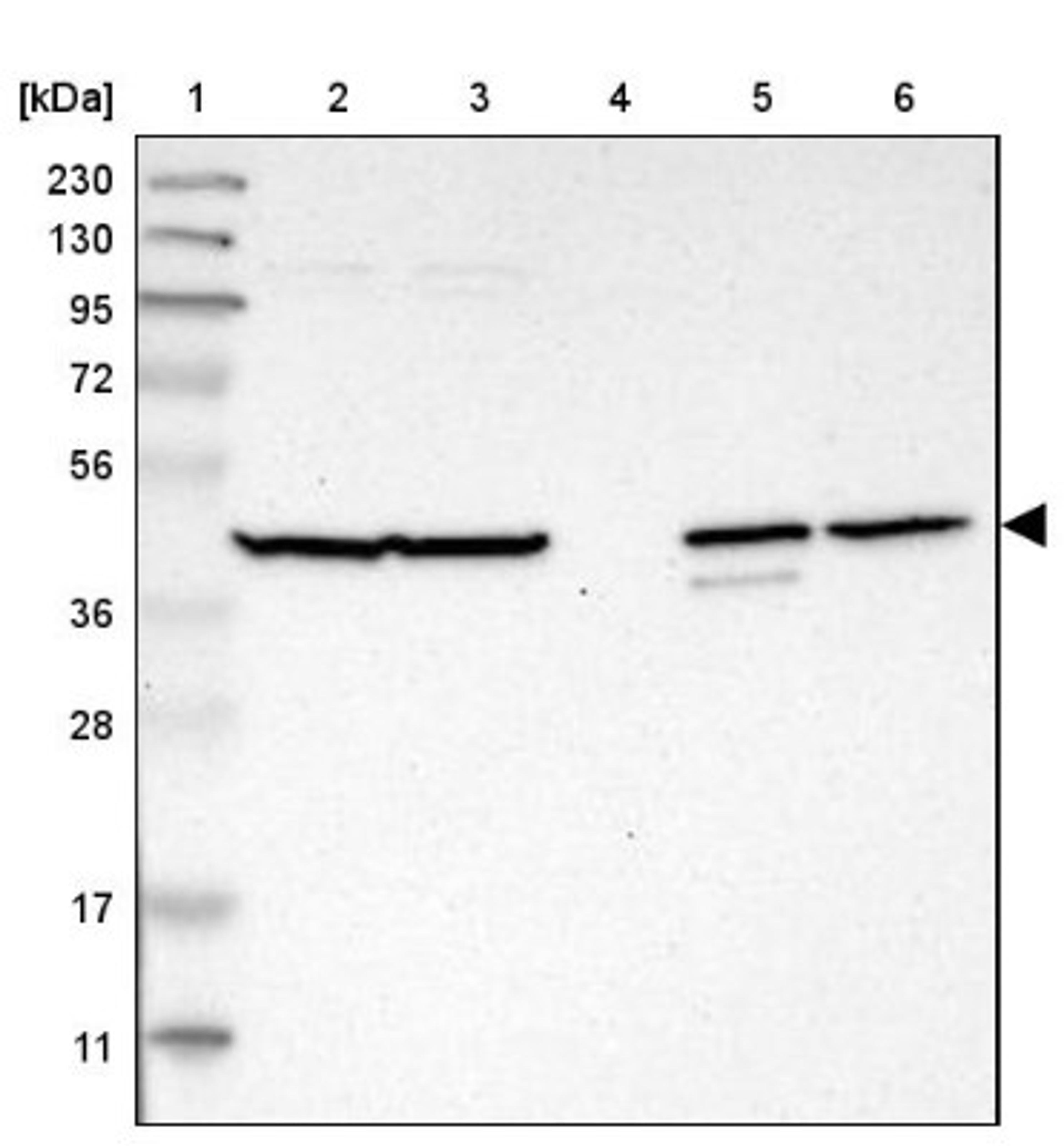 Western Blot: C1orf159 Antibody [NBP1-93971] - Lane 1: Marker [kDa] 230, 130, 95, 72, 56, 36, 28, 17, 11<br/>Lane 2: Human cell line RT-4<br/>Lane 3: Human cell line U-251MG sp<br/>Lane 4: Human plasma (IgG/HSA depleted)<br/>Lane 5: Human liver tissue<br/>Lane 6: Human tonsil tissue