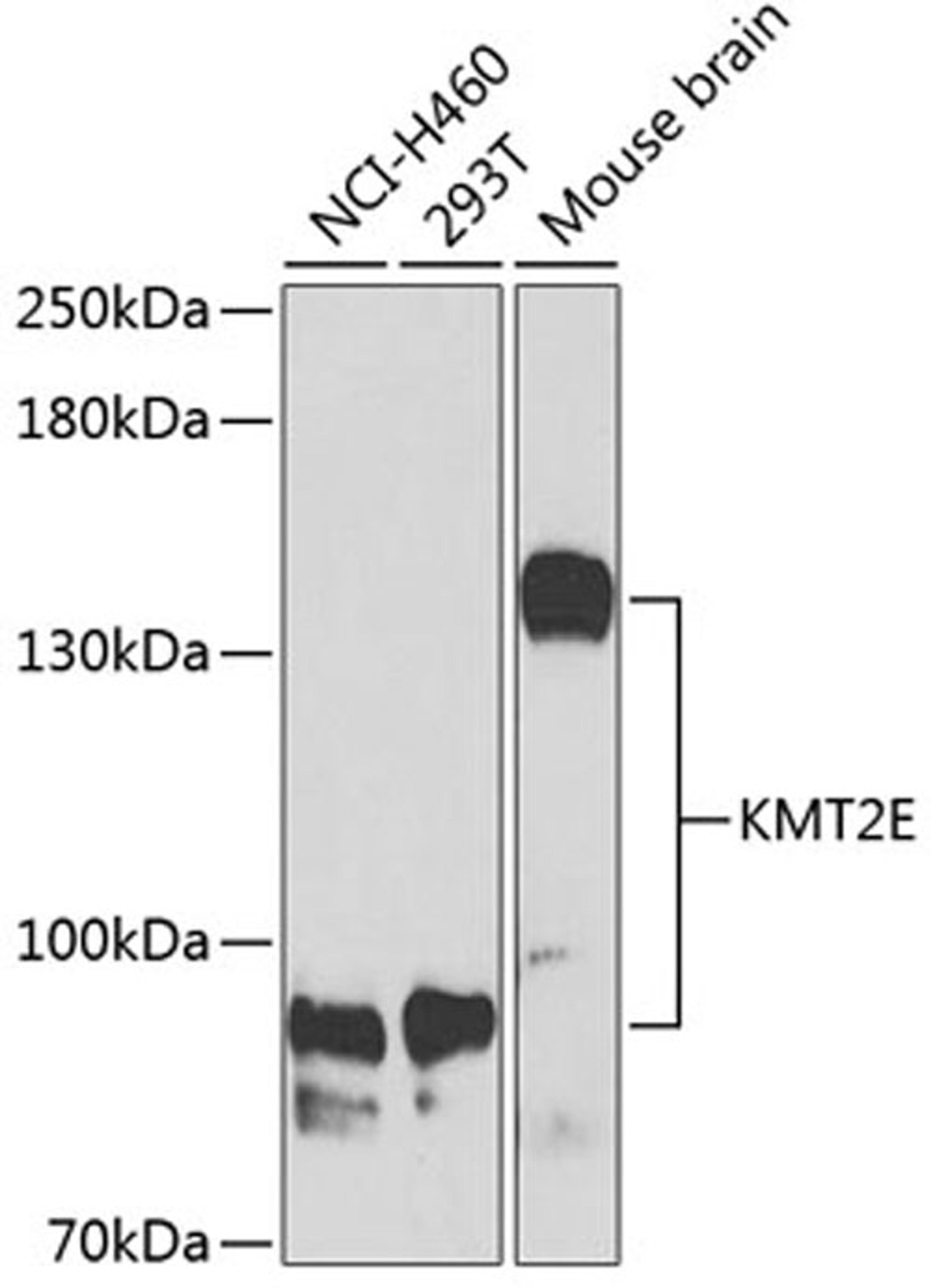 Western blot - KMT2E Antibody (A6142)