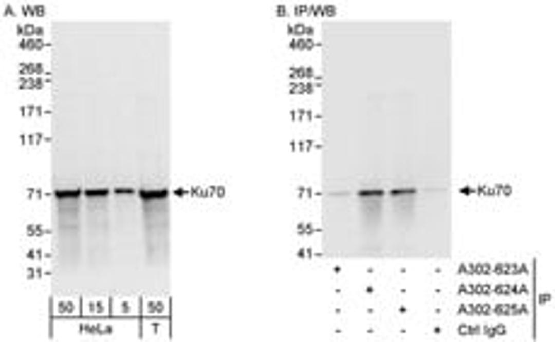 Detection of human Ku70 by western blot and immunoprecipitation.