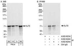 Detection of human Ku70 by western blot and immunoprecipitation.