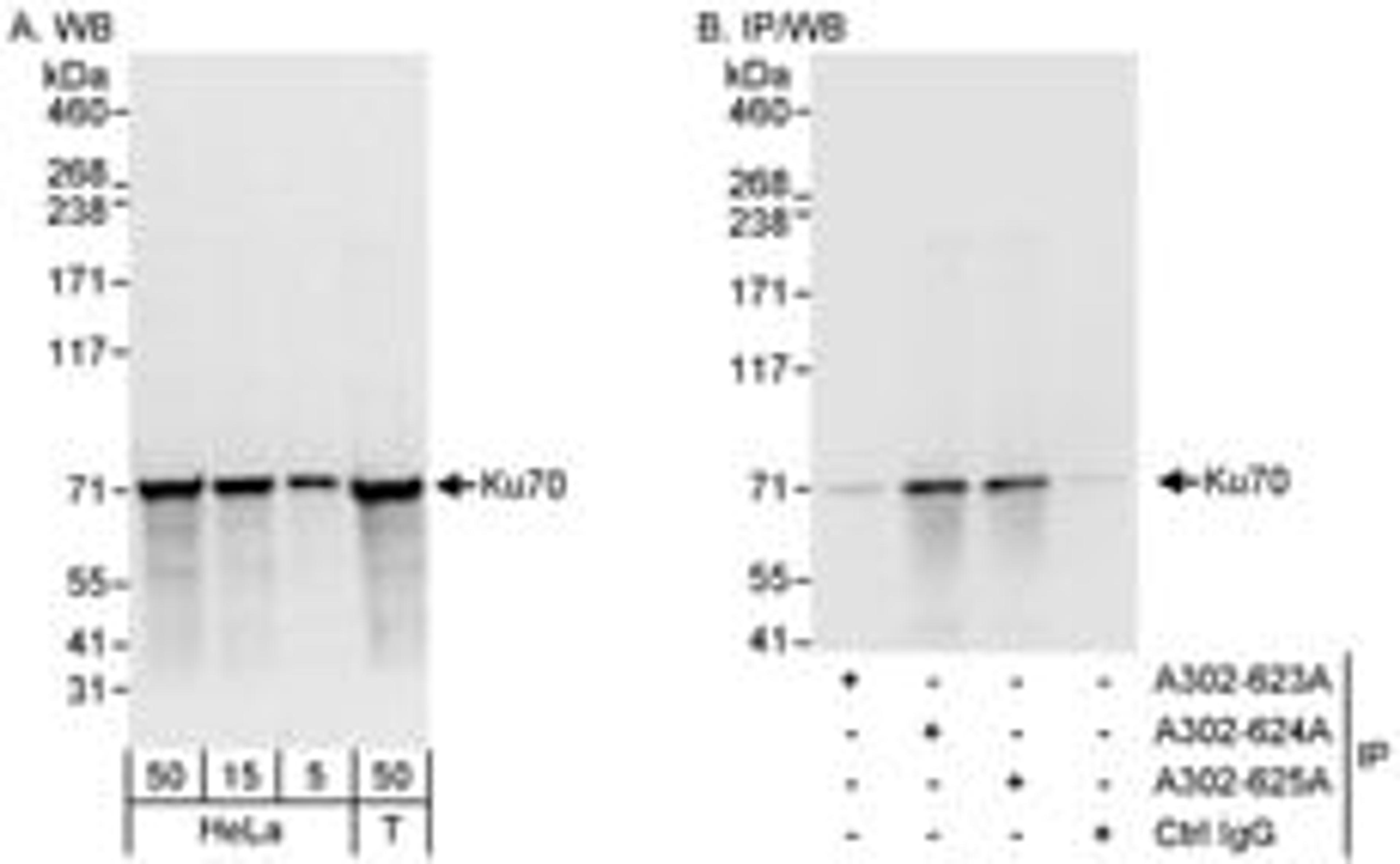 Detection of human Ku70 by western blot and immunoprecipitation.