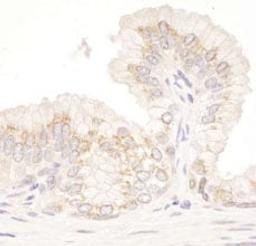 Detection of human GM130 by immunohistochemistry.