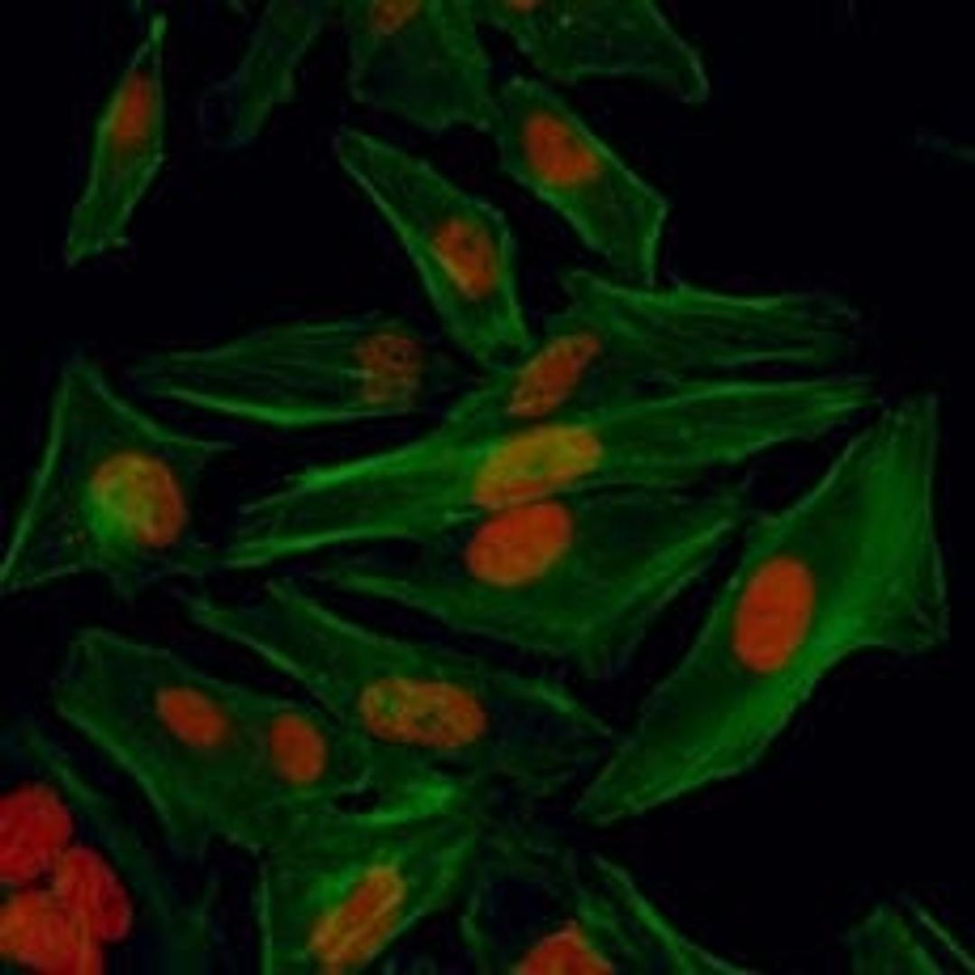 Detection of human HIF1-alpha by immunocytochemistry.