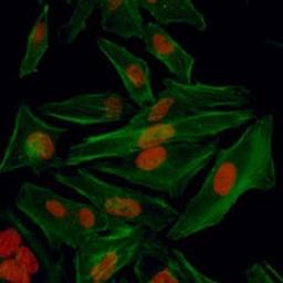 Detection of human HIF1-alpha by immunocytochemistry.