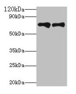 Western blot. All lanes: Klkb1 antibody at 2µg/ml. Lane 1: Hela whole cell lysate. Lane 2: Rat brain tissue. Secondary. Goat polyclonal to rabbit IgG at 1/10000 dilution. Predicted band size: 72 kDa. Observed band size: 72 kDa