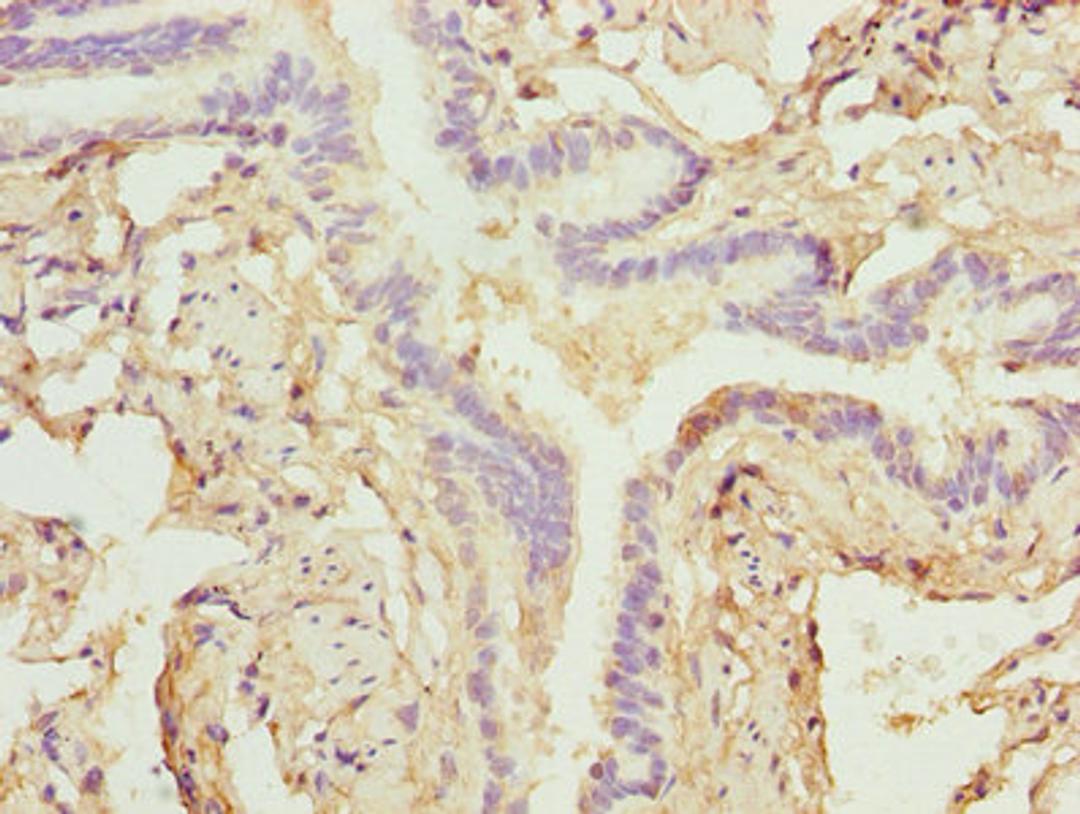Immunohistochemistry of paraffin-embedded human lung tissue using CSB-PA026582LA01HU at dilution of 1:100