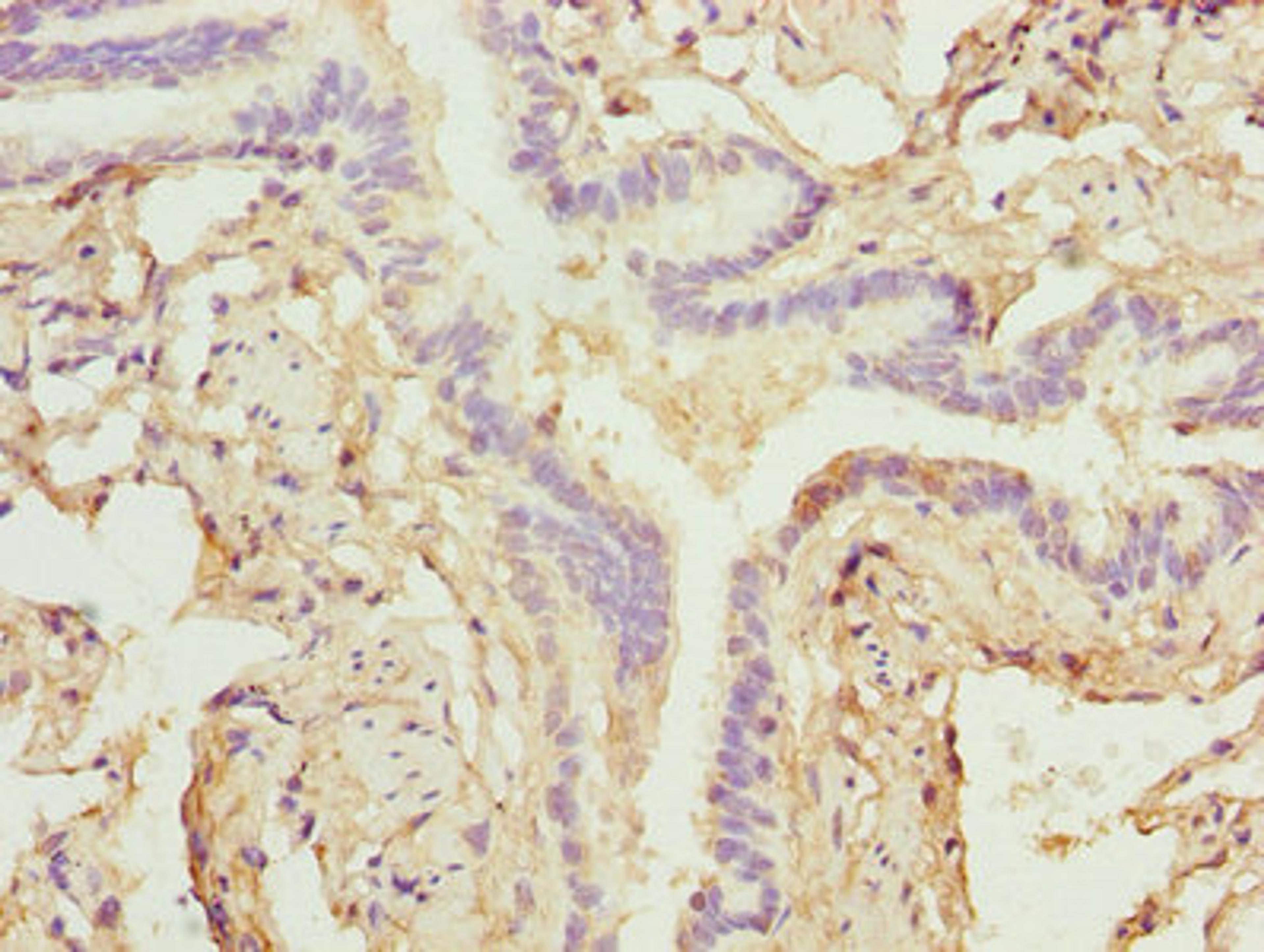 Immunohistochemistry of paraffin-embedded human lung tissue using CSB-PA026582LA01HU at dilution of 1:100