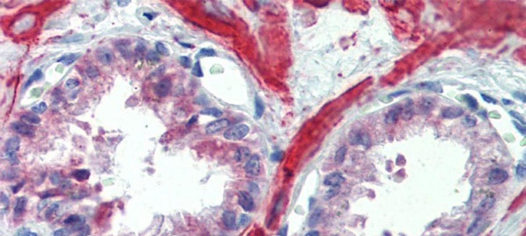 Antibody used in IHC on Human Prostate at 5.0 ug/ml.