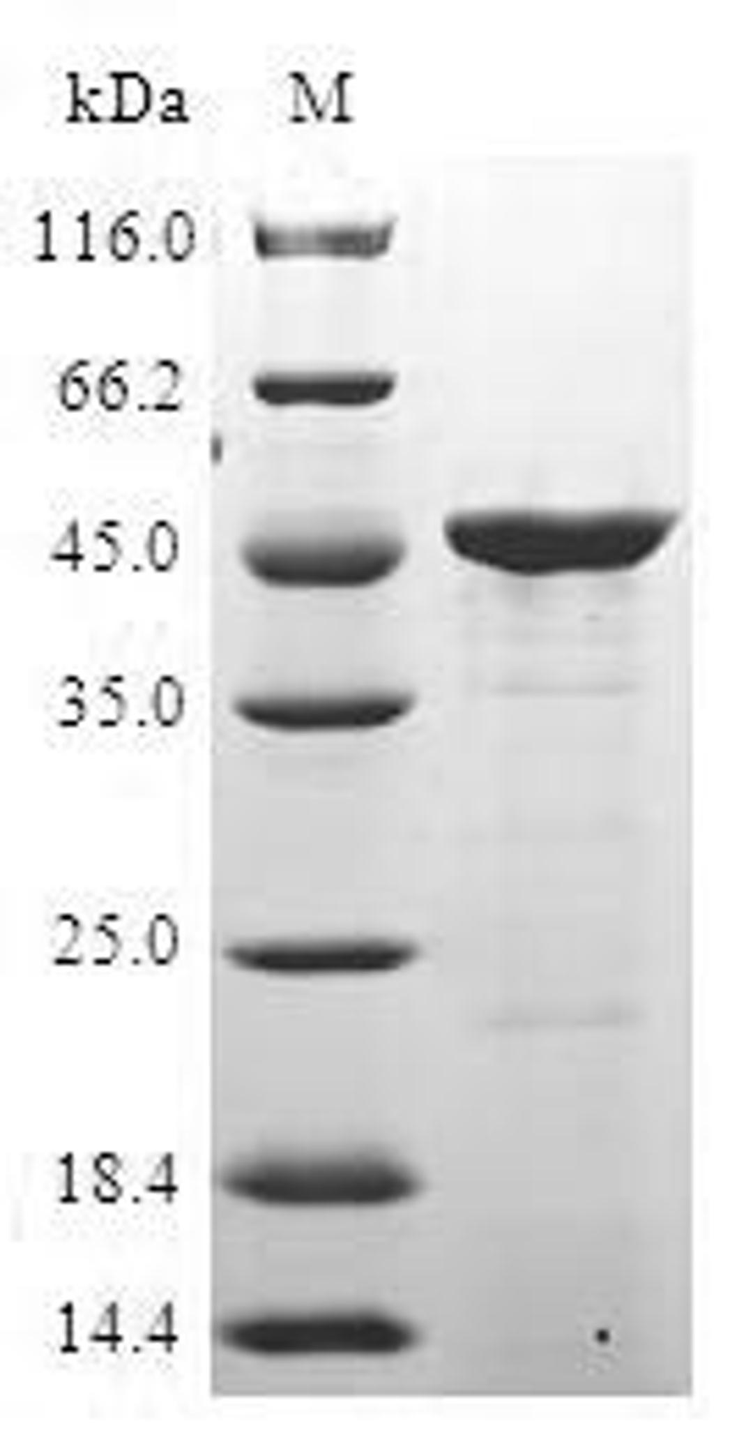 (Tris-Glycine gel) Discontinuous SDS-PAGE (reduced) with 5% enrichment gel and 15% separation gel.