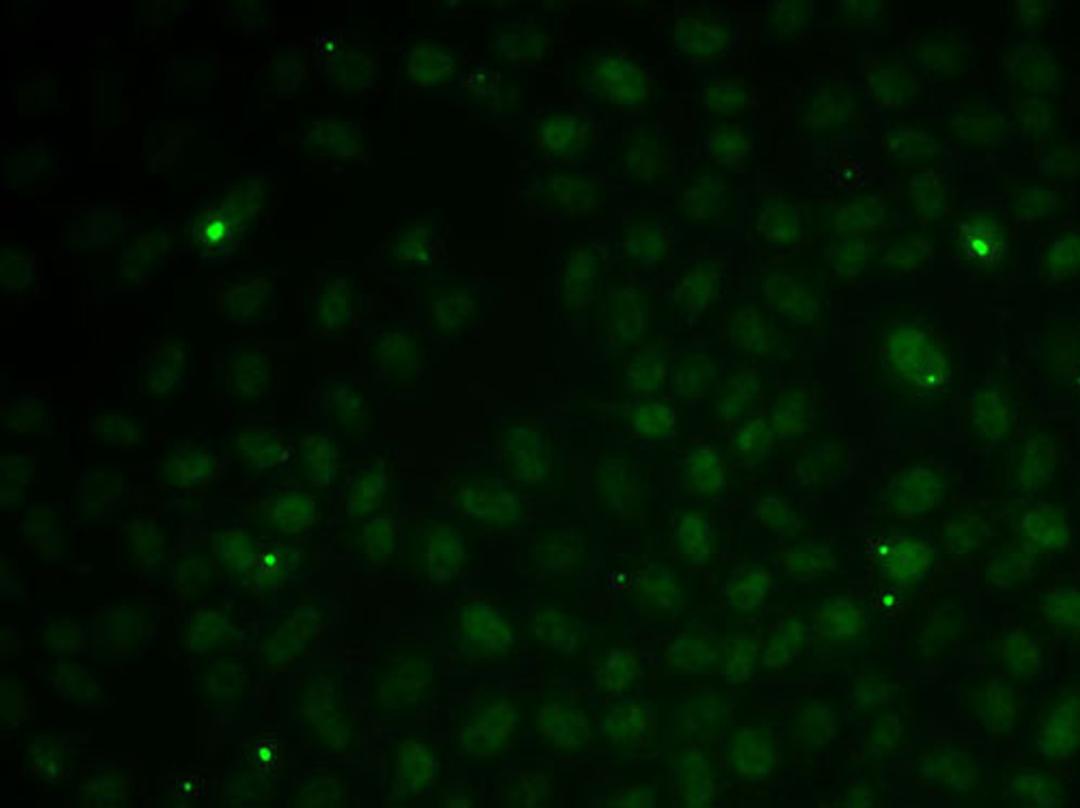 Immunofluorescence - RAD51C antibody (A12487)