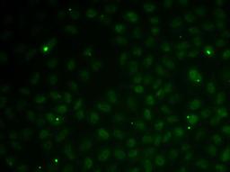 Immunofluorescence - RAD51C antibody (A12487)