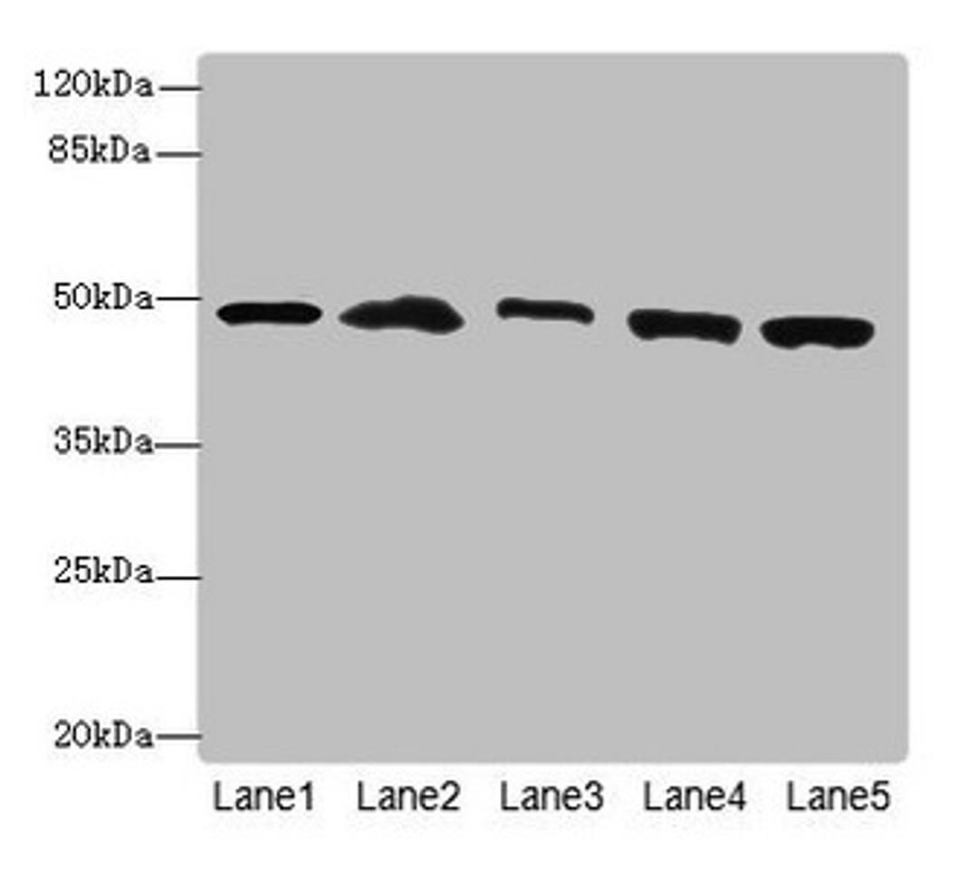 Western blot. All lanes: PSMD13antibody at 3.42ug/ml. Lane 1: Mouse lung tissue. Lane 2: 293T whole cell lysate. Lane 3: Hela whole cell lysate. Lane 4: HepG2 whole cell lysate. Lane 5: Jurkat whole cell lysate. Secondary. Goat polyclonal to rabbit IgG at 1/10000 dilution. Predicted band size: 43 kDa. Observed band size: 43 kDa. 