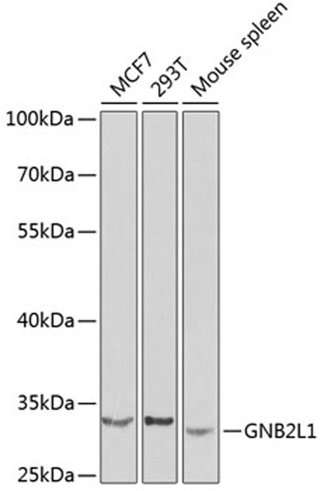 Western blot - GNB2L1 antibody (A0151)