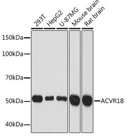 Western blot - ACVR1B Rabbit mAb (A2279)