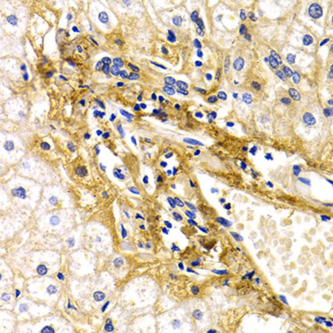 Immunohistochemistry  - CFH antibody (A2166)