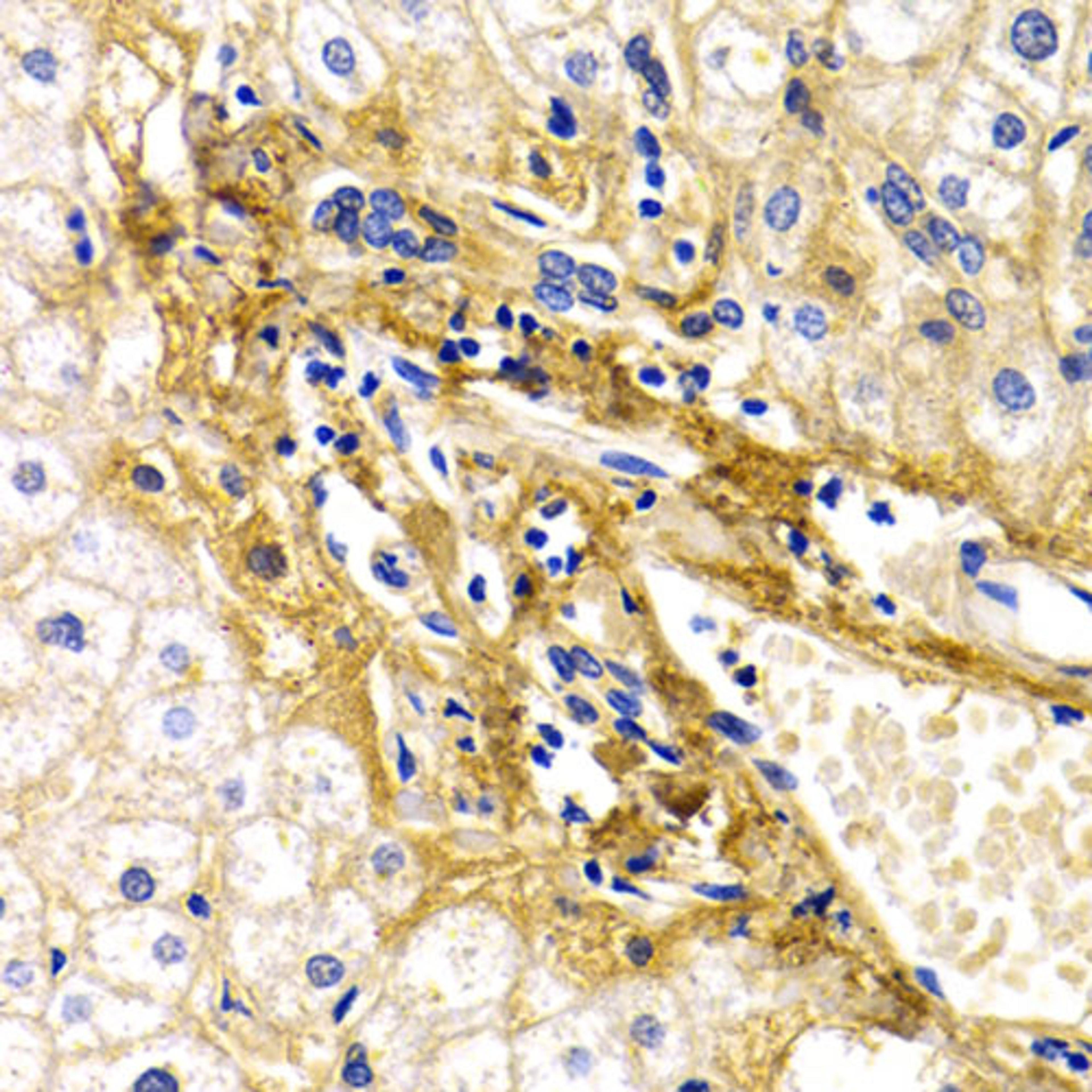 Immunohistochemistry - CFH antibody (A2166)