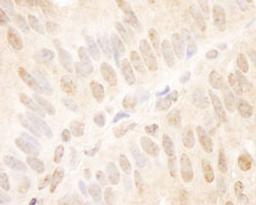 Detection of human TCF12 by immunohistochemistry.