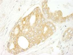 Detection of human BRAF by immunohistochemistry.