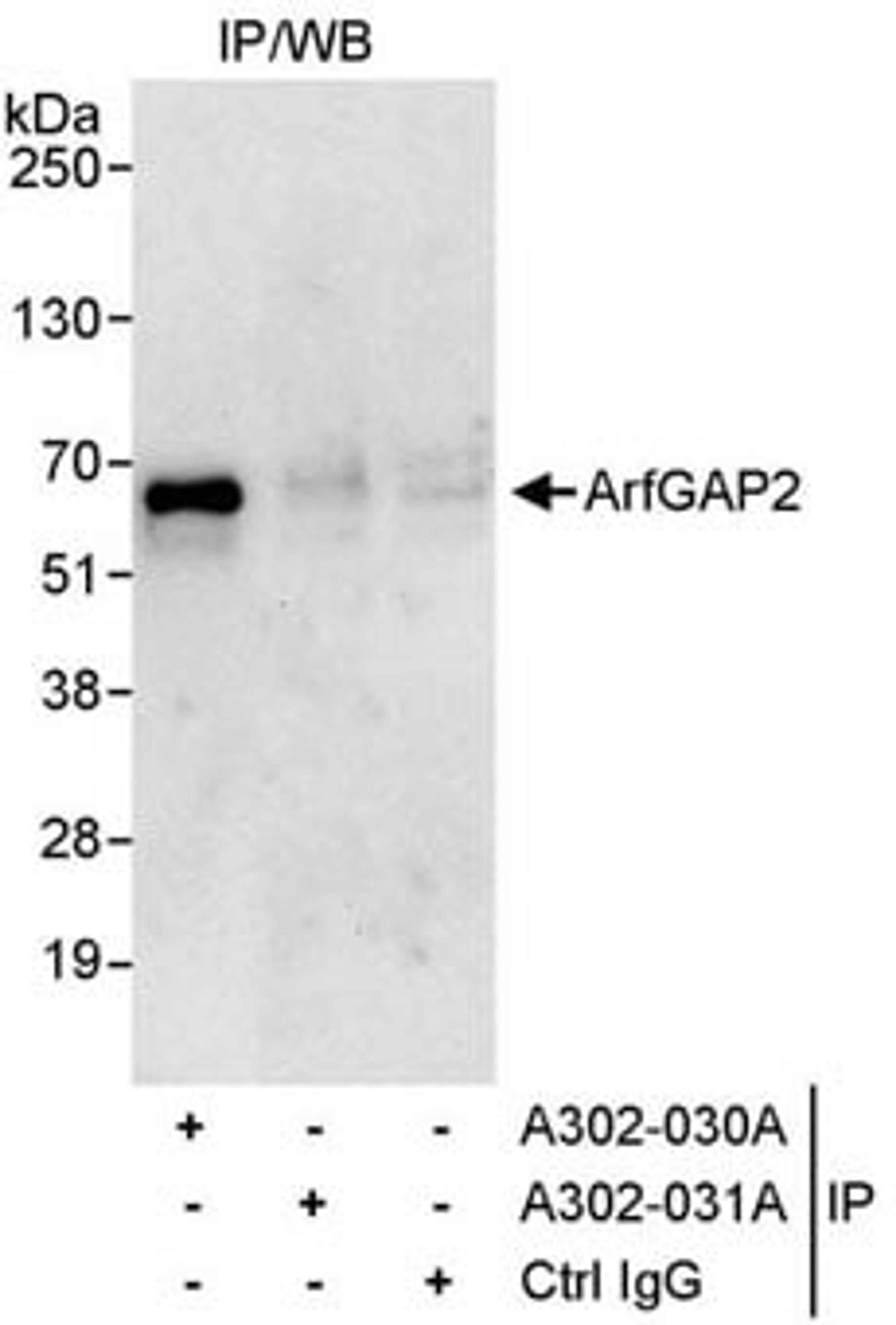 Detection of human ArfGAP2 by western blot of immunoprecipitates.