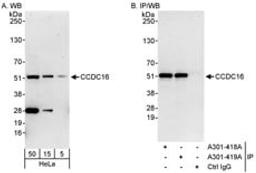 Detection of human CCDC16 by western blot and immunoprecipitation.