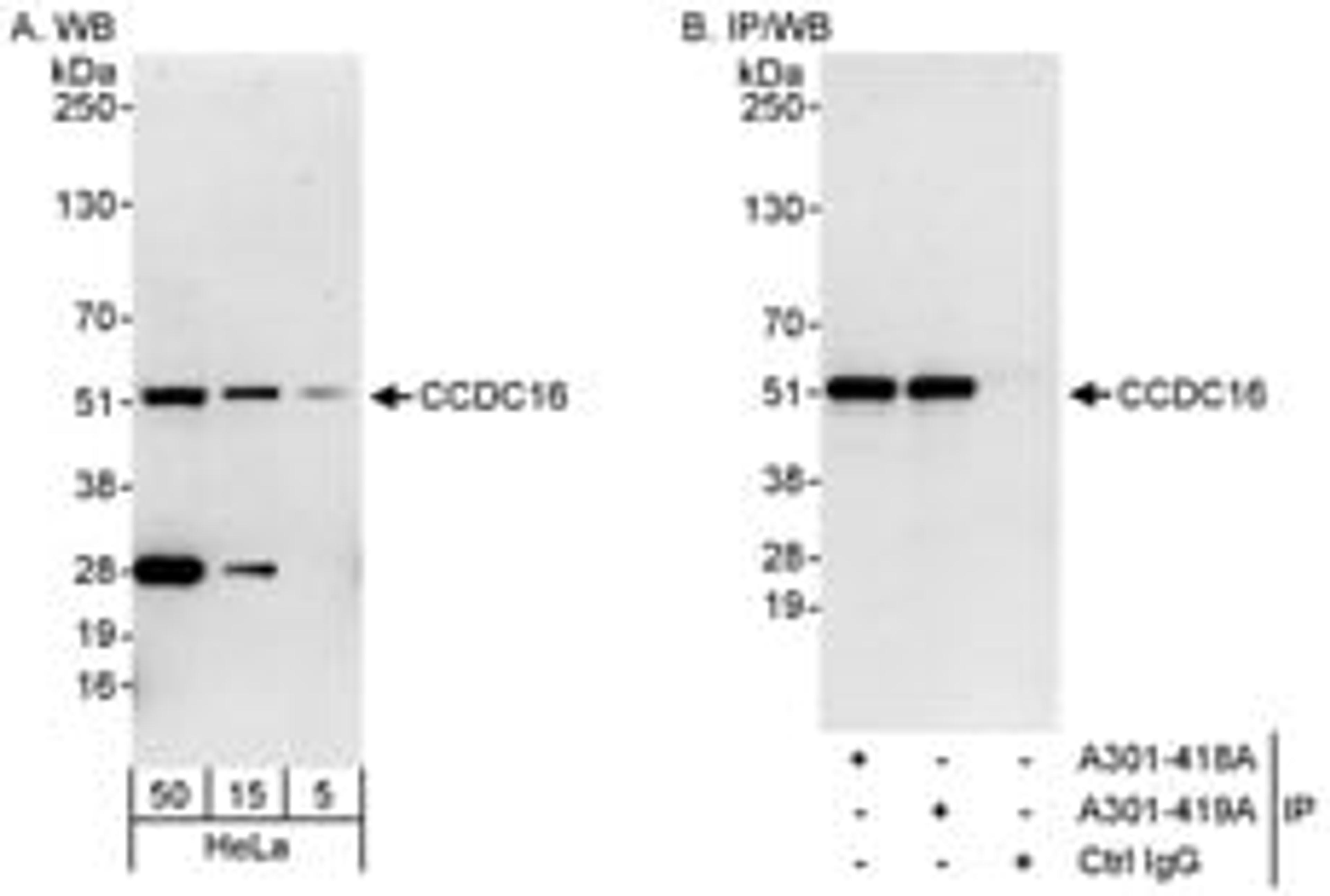 Detection of human CCDC16 by western blot and immunoprecipitation.