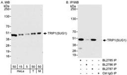 Detection of human and mouse TRIP1(SUG1) by western blot (h&m) and immunoprecipitation (h).